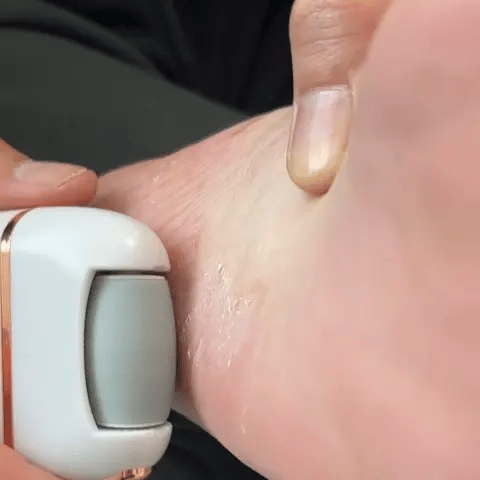 SuaviFeet™ – Removedor de callos eléctrico recargable, deja tus pies suaves en minutos.